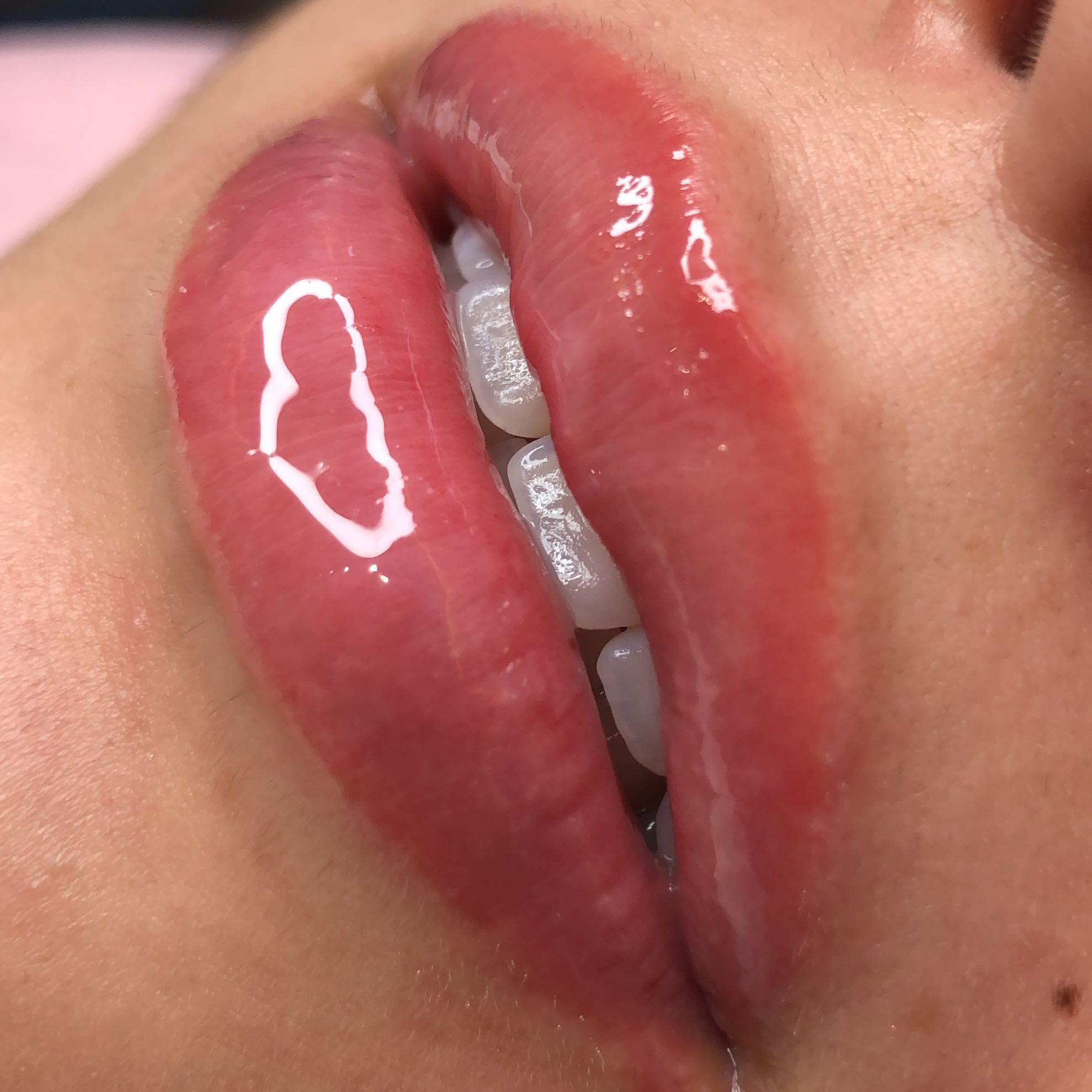 Portfólio de Hidratação Labial (hidra lips, pump lips)