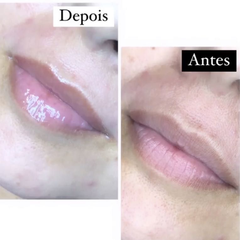 Portfólio de Hidratação Labial (hidra lips, pump lips)