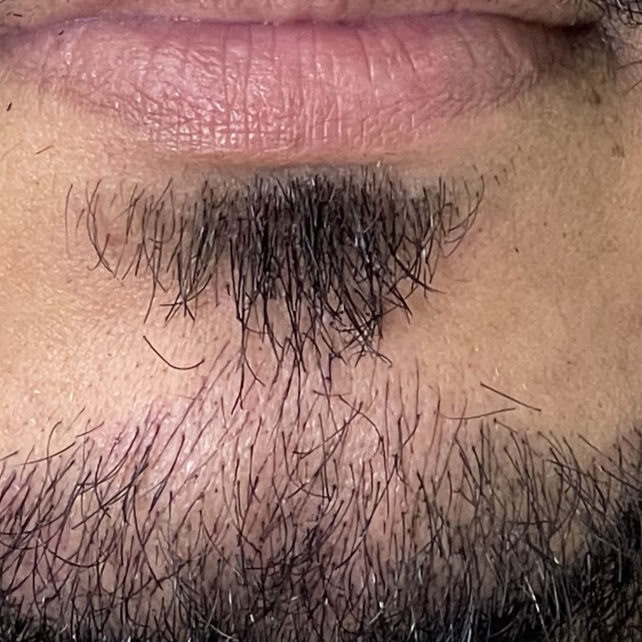 Portfólio de Preenchimento de barba mano  fio