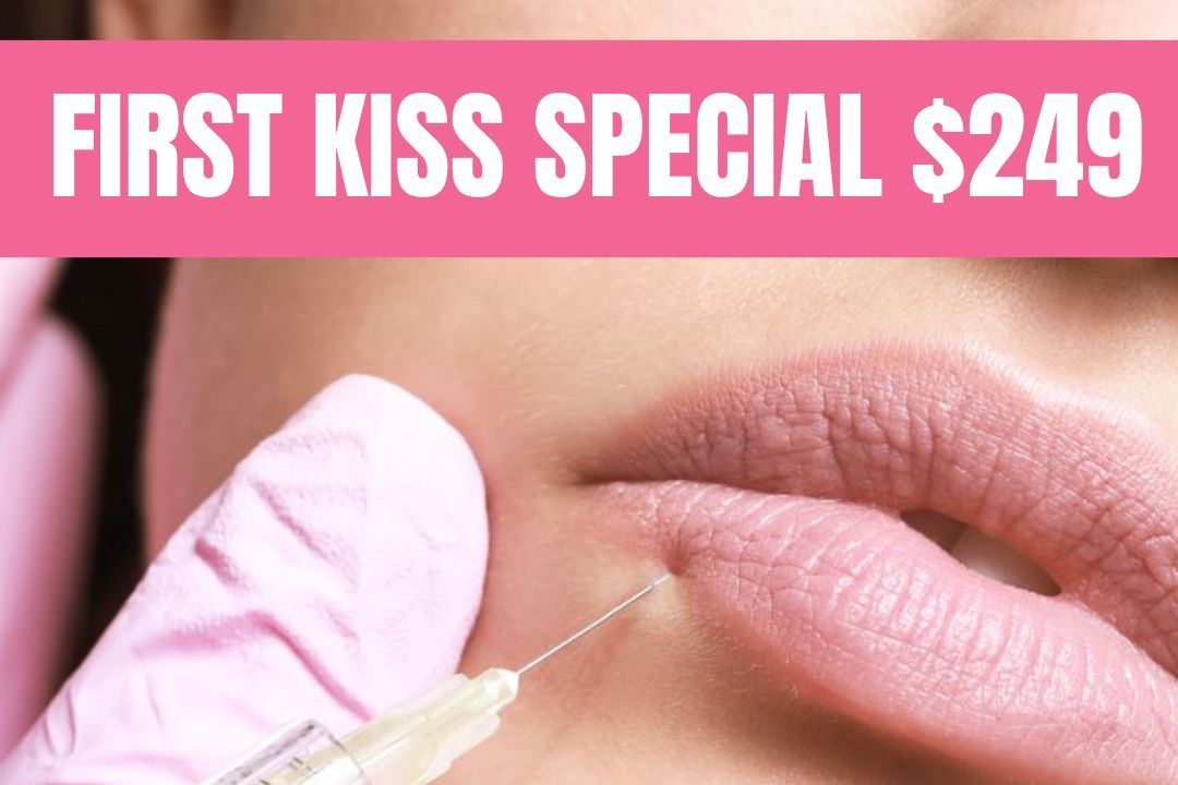 FIRST KISS SPECIAL (1/2 syringe JUVÉDERM®) portfolio