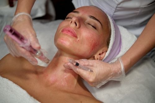 Med-Spa Skin Treatments portfolio