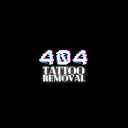 404 Tattoo Removal, 25 S Quaker Ln, Suite 7, Alexandria, 22314