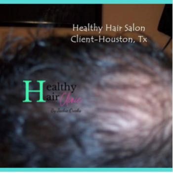 Man Consultation For Hair Loss Solution $65 portfolio