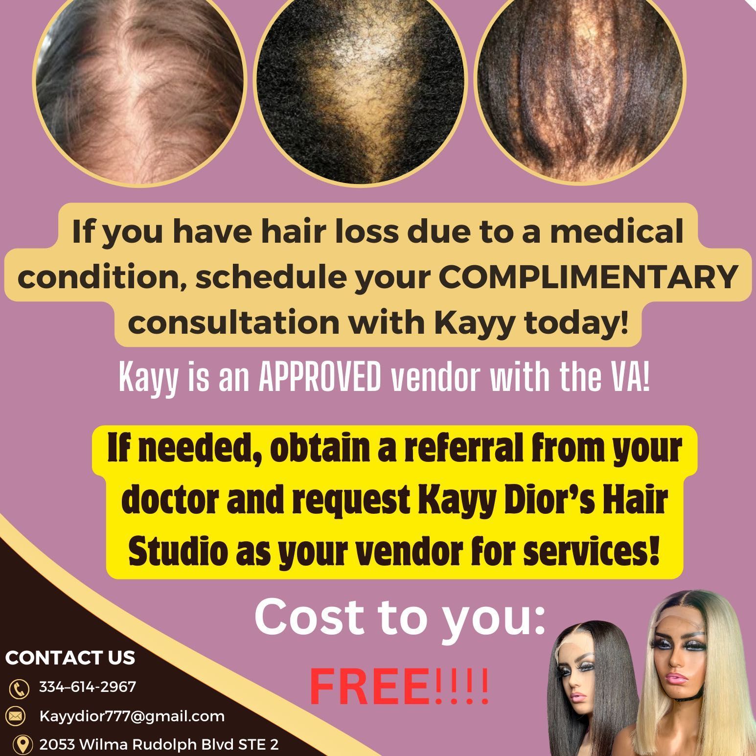 Hair Loss Replacement Consultation portfolio