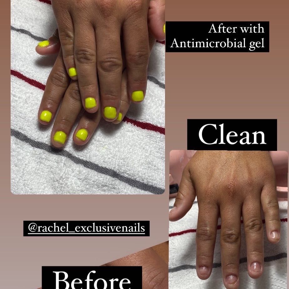 Nail Reconstrucion👣 💅🏾 With antimicrobial gel only portfolio