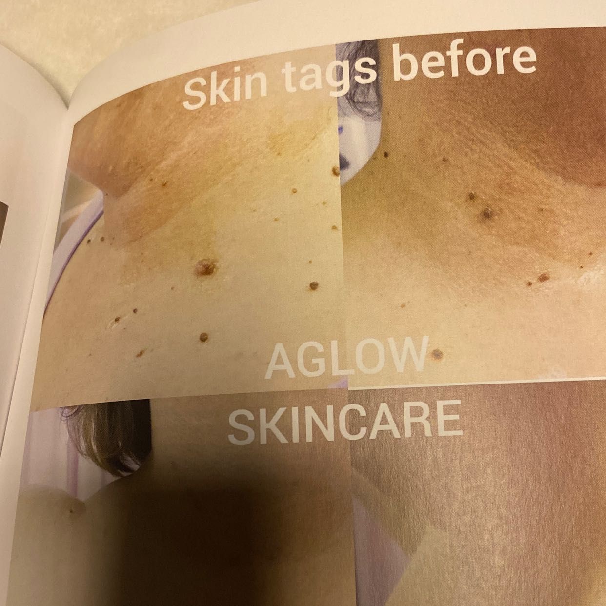 Skin Tags portfolio