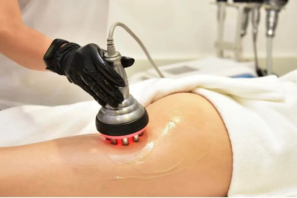 Ultrasound Cavitation with RF Vacuum Massage portfolio