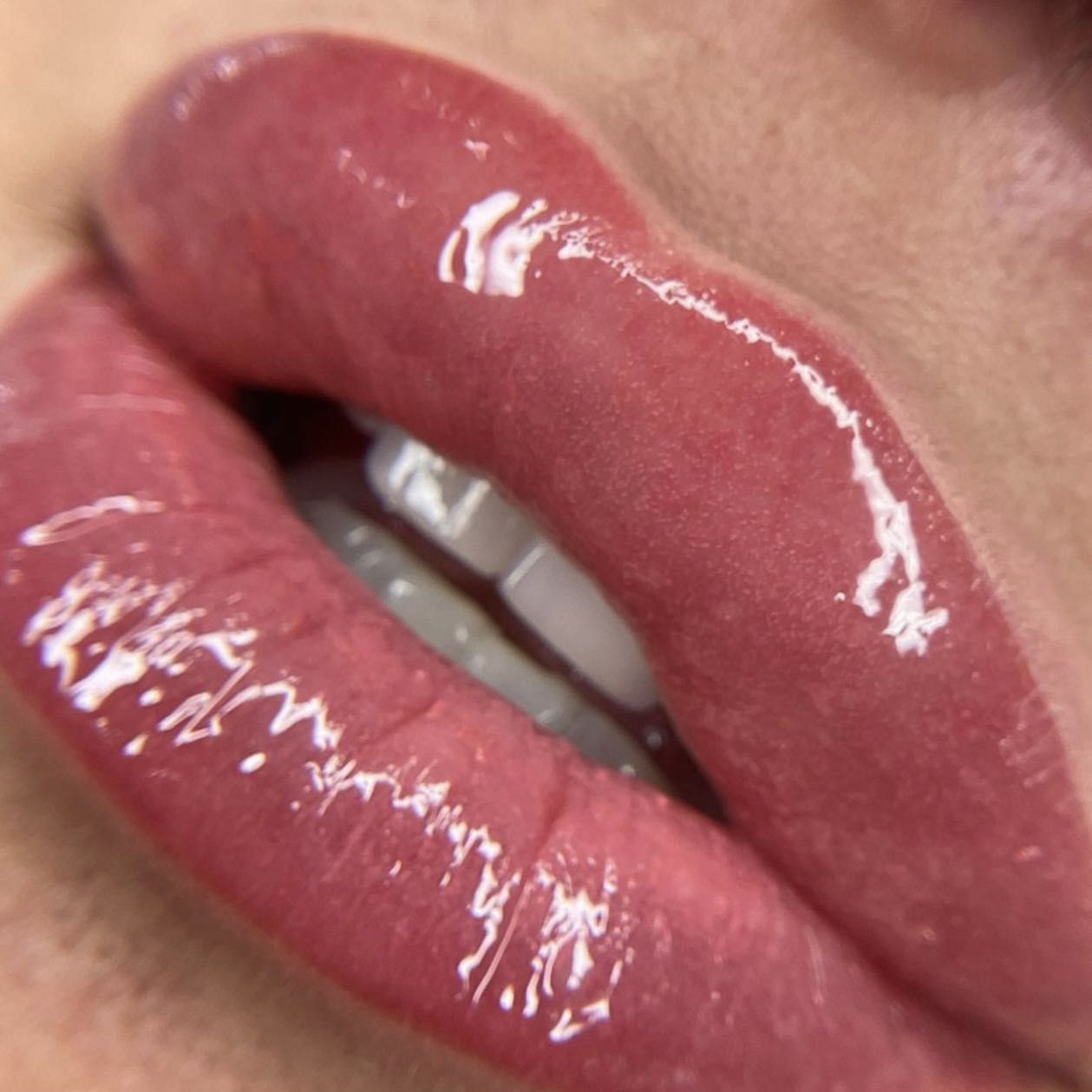 Cherry Lips portfolio
