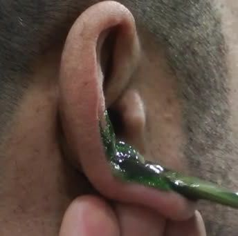 EAR WAXING / depilación de los oídos portfolio