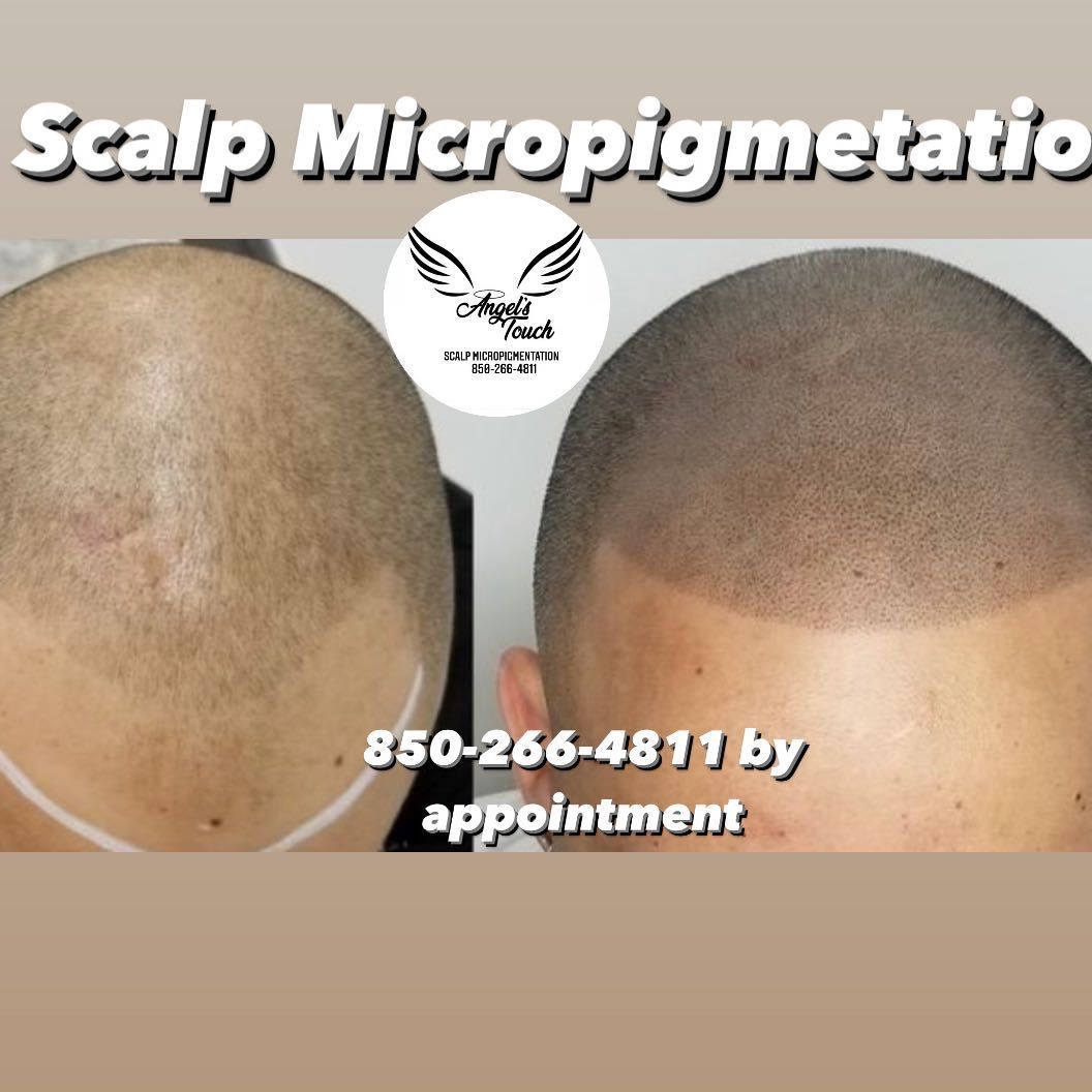 Scalp micropigmentation portfolio