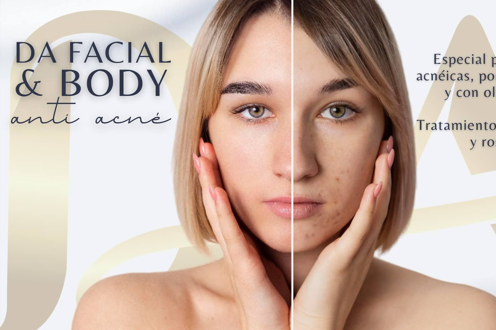 DA Facial & Body Anti Acne portfolio