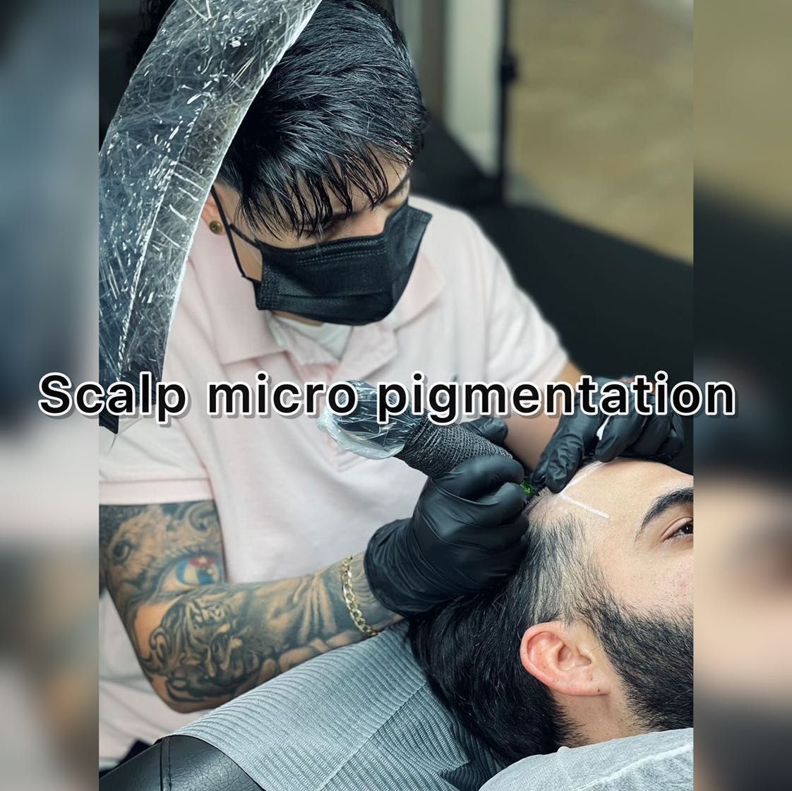 Scalp micro pigmentation. ( S.M.P )  consultation portfolio