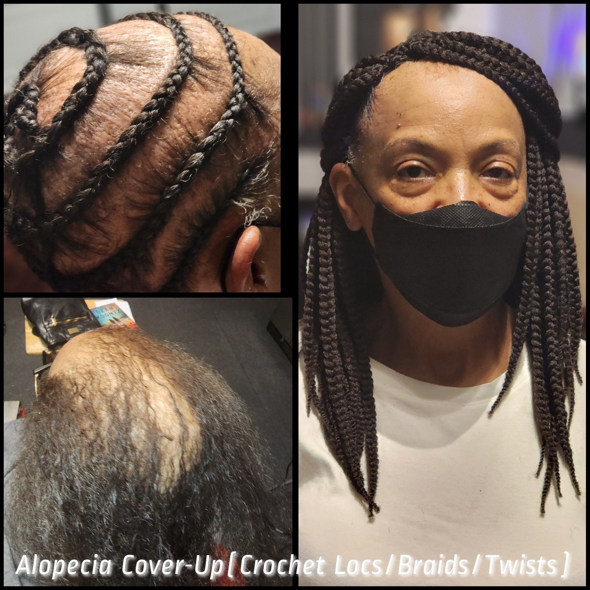 Alopecia Cover-Up (Crochet Locs/Twists/Braids) portfolio