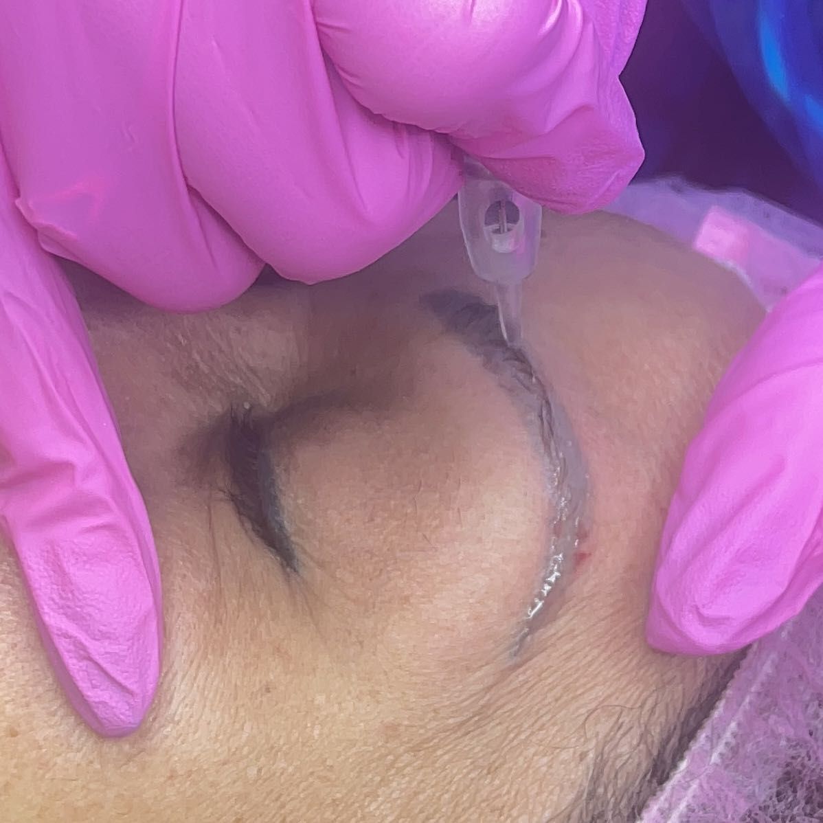 3 sections of eyebrow removal portfolio