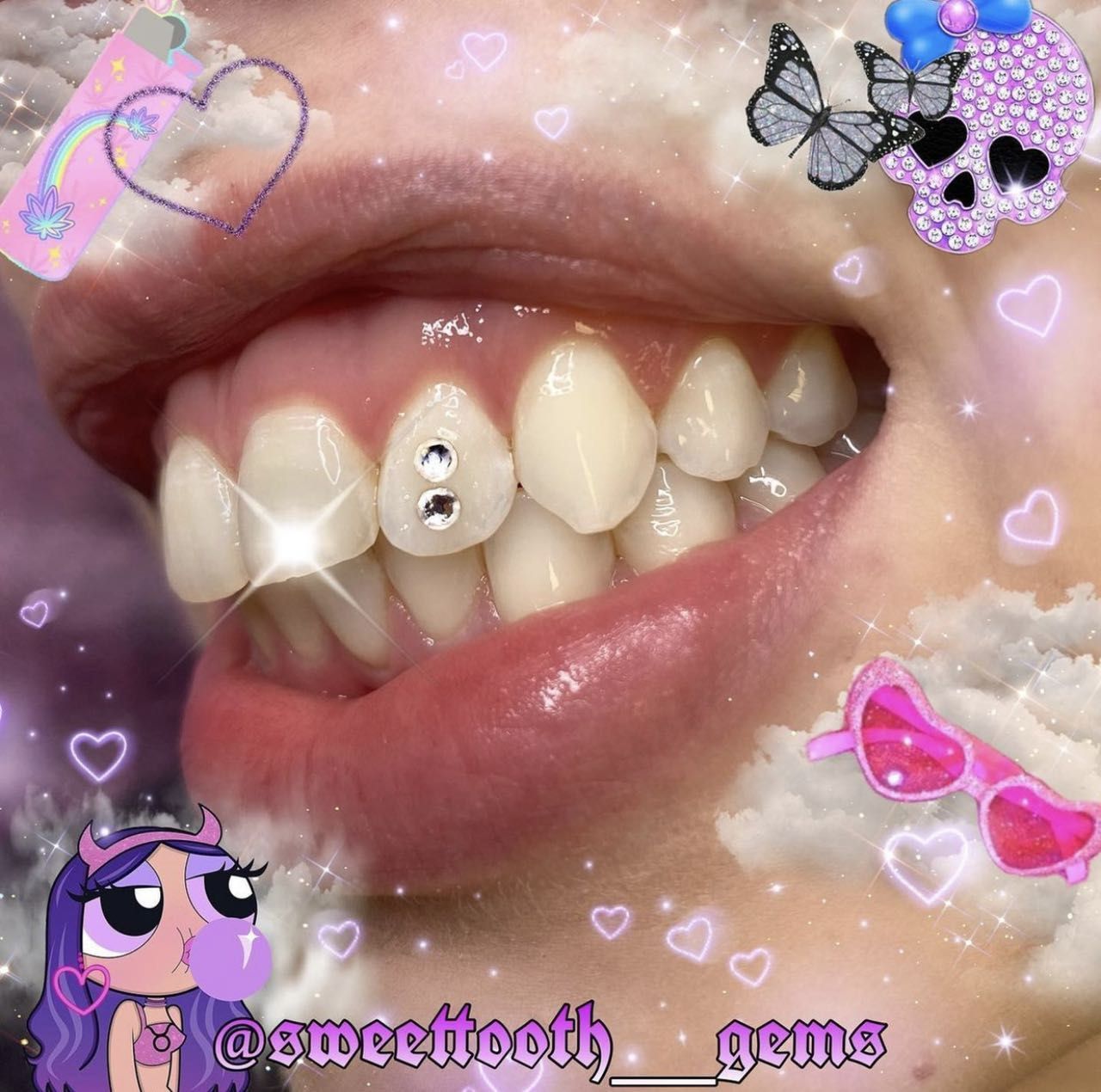 Tooth gem with Raynie portfolio