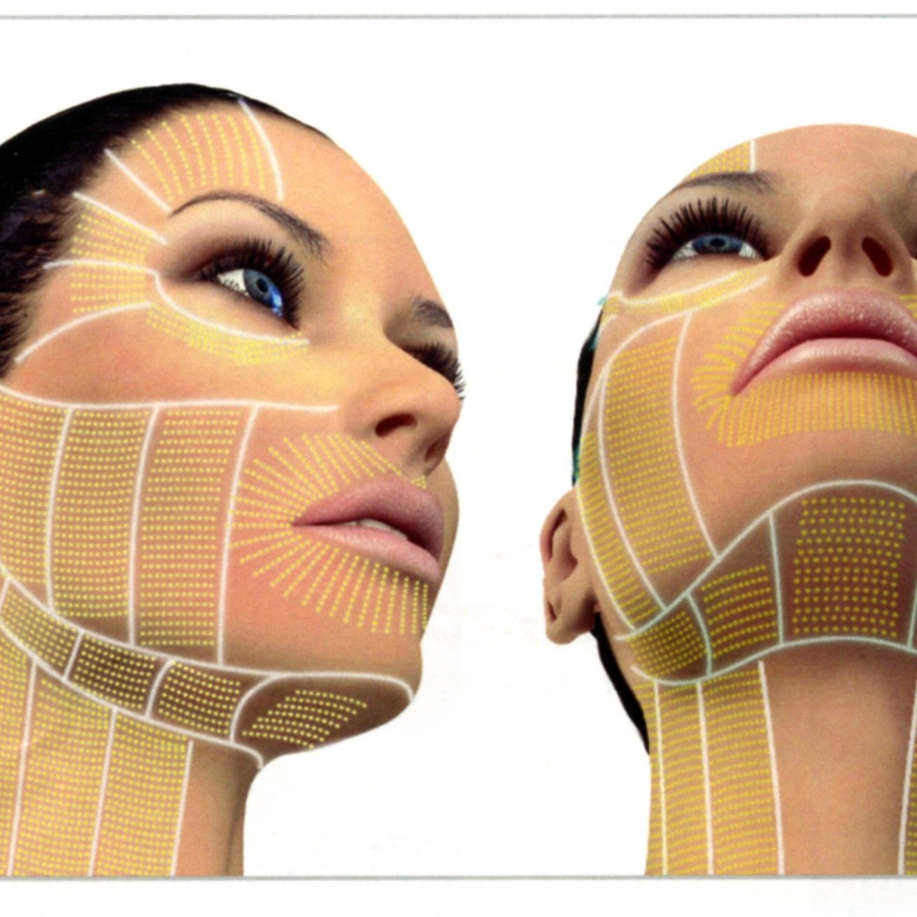 Ultherapy (FULL FACE, NECK, CHEST) portfolio