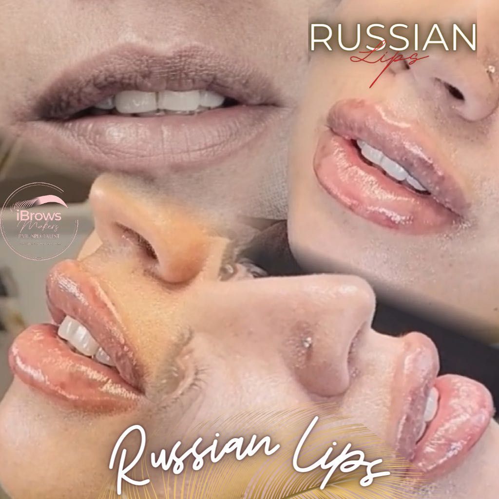 RUSSIAN LIPS Fillers Hyaluronic Acid portfolio