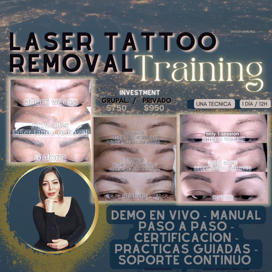 Trainning Laser Tatoo Removal portfolio