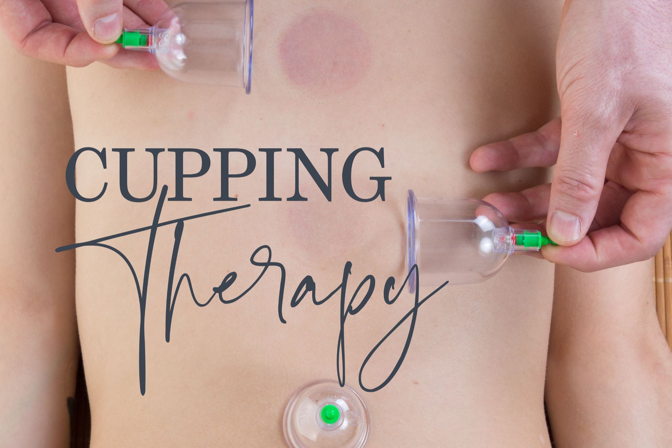 Upper Body Cupping Therapy & Massage portfolio
