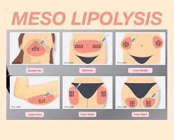 Meso therapy Lipolysis portfolio