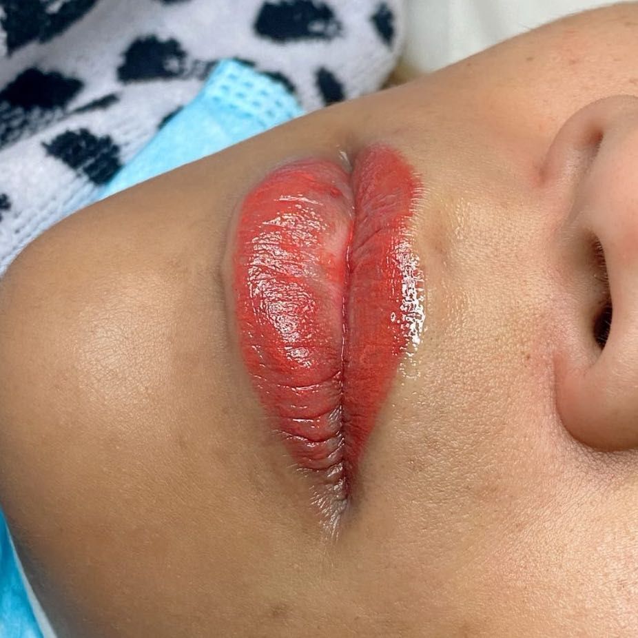 Lips Blush (pigmentación de labios) portfolio