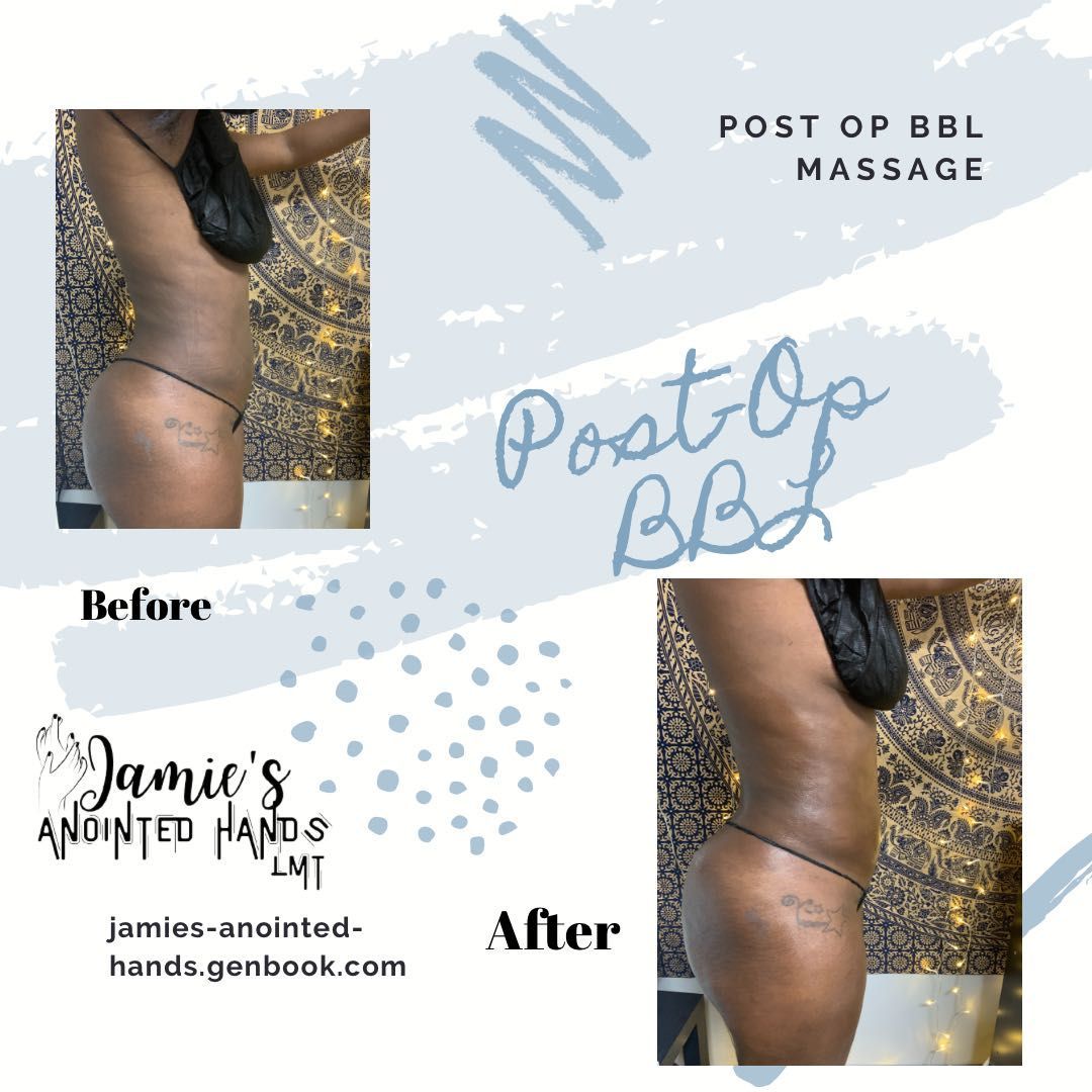 Post Op Massage Pkg of 4 portfolio