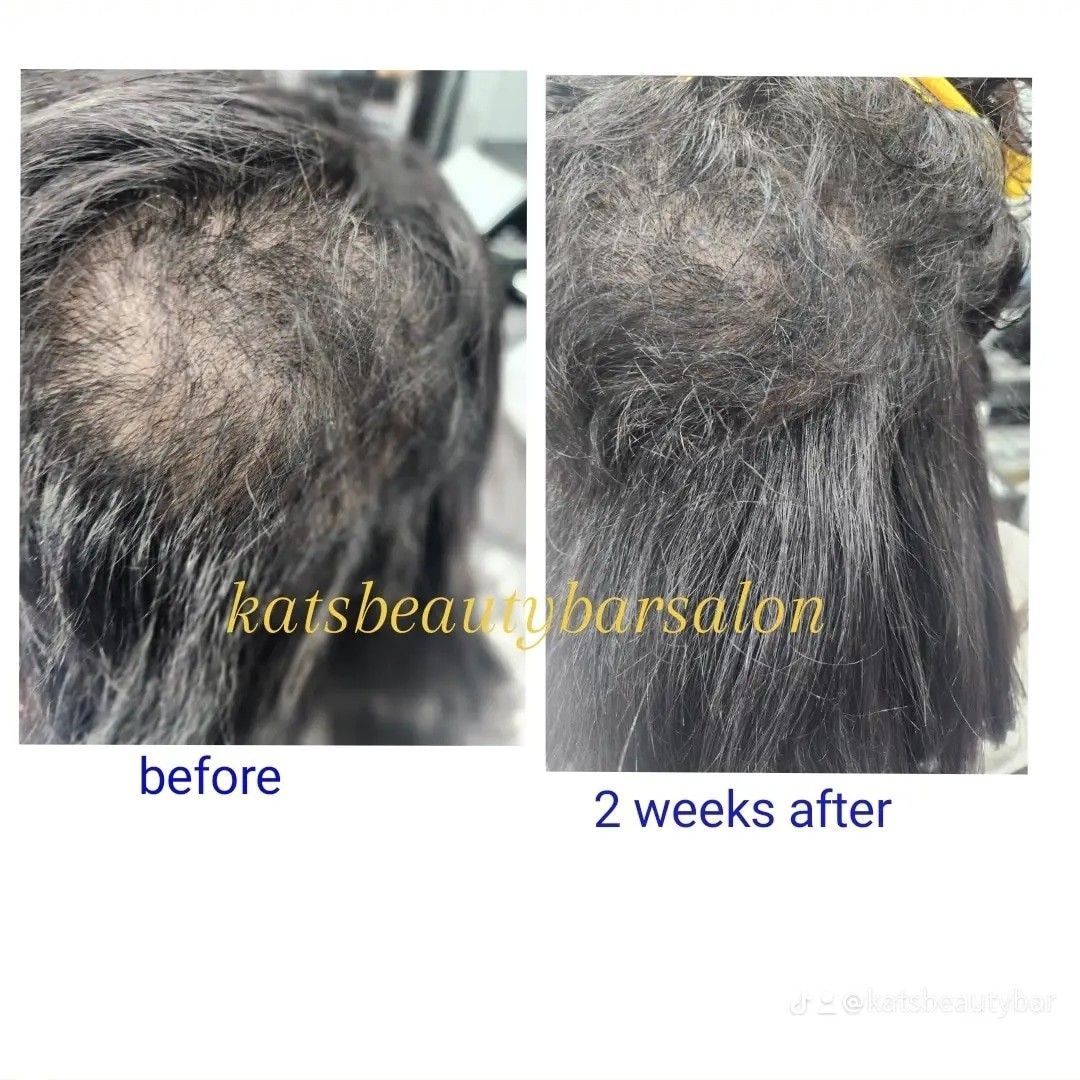 Hair Loss Treatment portfolio