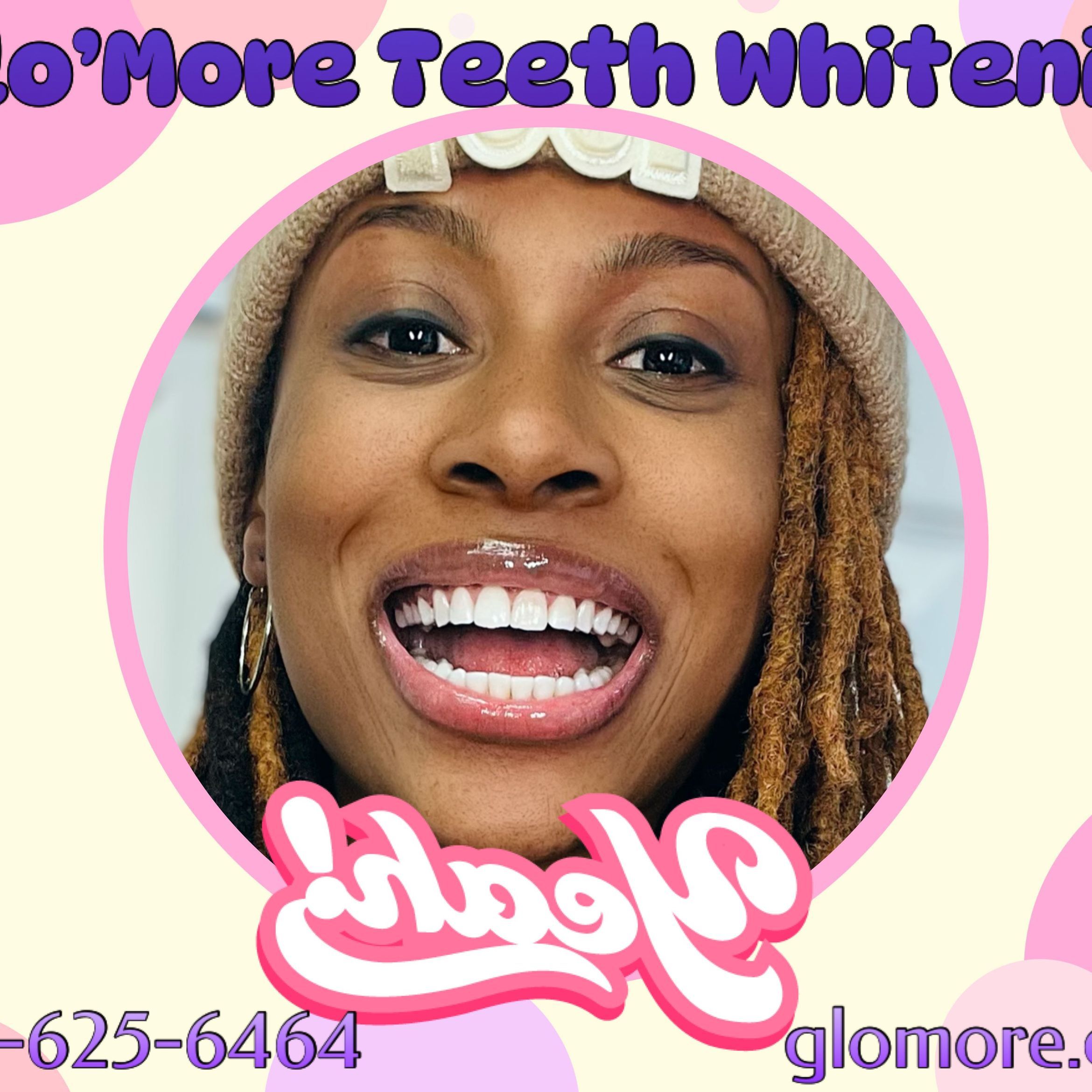 Teeth Whitening Initial Service portfolio