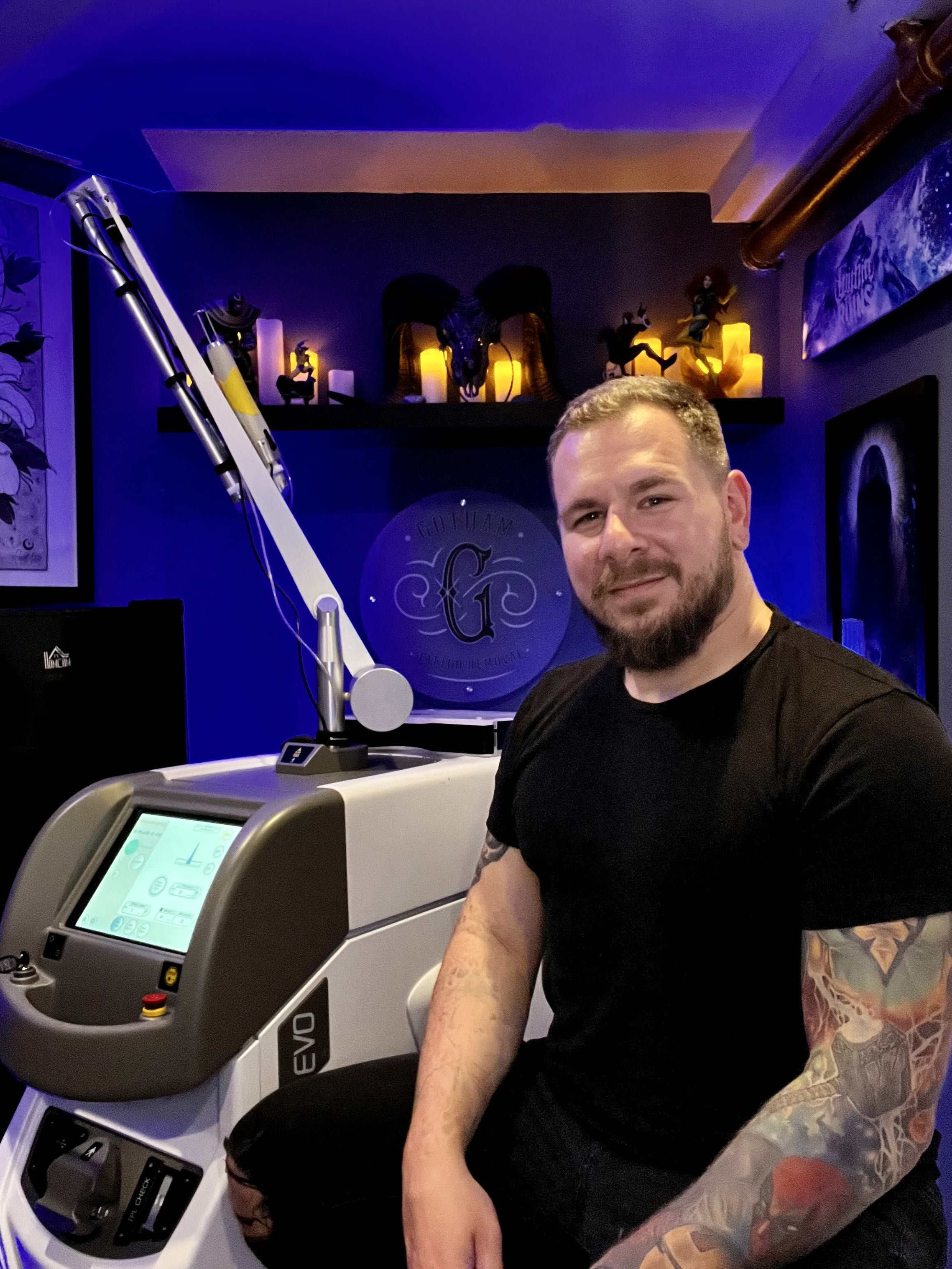 Laser Tattoo Removal  Before and After  Prime Aesthetica