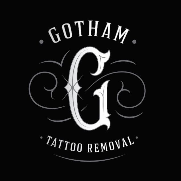 Tattoo Removal Session (For Returning Clients) portfolio