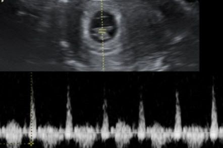 Early Peek 2D Ultrasound Package (8-13 weeks ONLY) portfolio