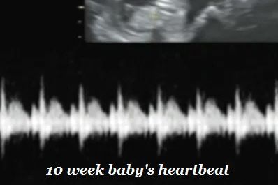 Baby's Heartbeat Package portfolio