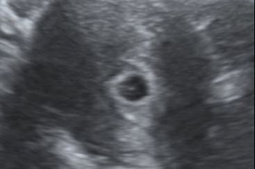 Pregnancy Confirmation portfolio