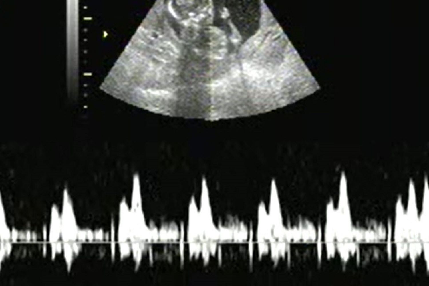 Early Peek 2D Ultrasound Package (8-13 weeks ONLY) portfolio