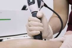 Shockwave Therapy ONLY - New Patient portfolio