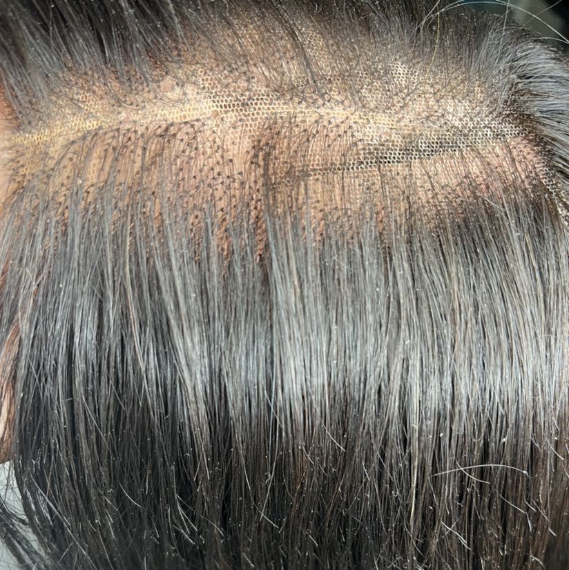 Wig Repair (Baldness) portfolio