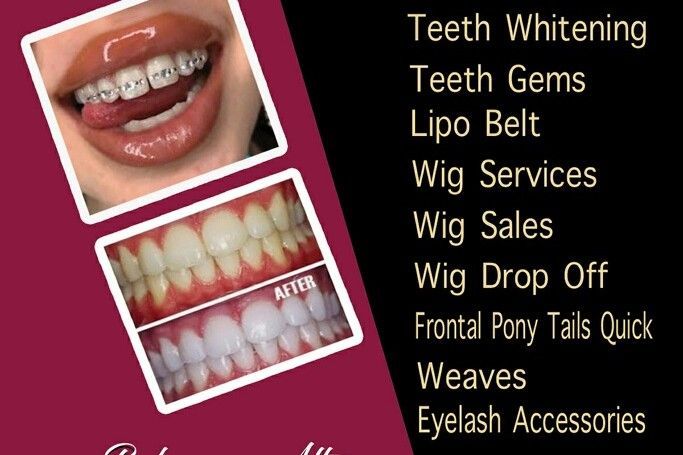 2 Teeth Gems - Products - Sparkling Smile Spa - Cosmetic Dentist