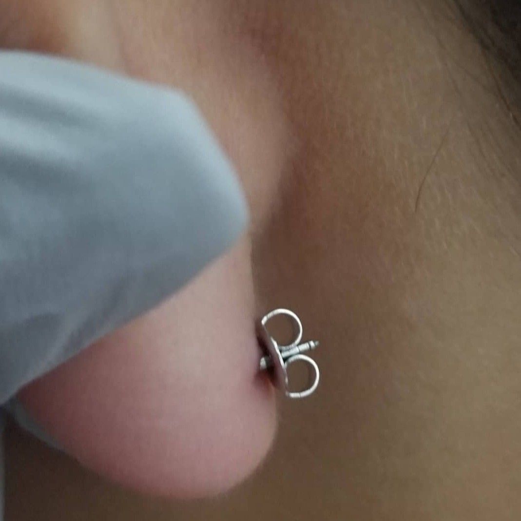 Ear piercing (upper and lower lobe) portfolio