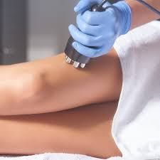 Deluxe thigh Cellulite Treatment RF/Wood therapy portfolio