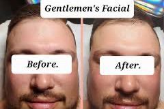 Gentleman's / Facial de Caballeros portfolio