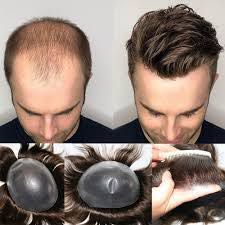 Men’s Hair Piece (toupee) portfolio