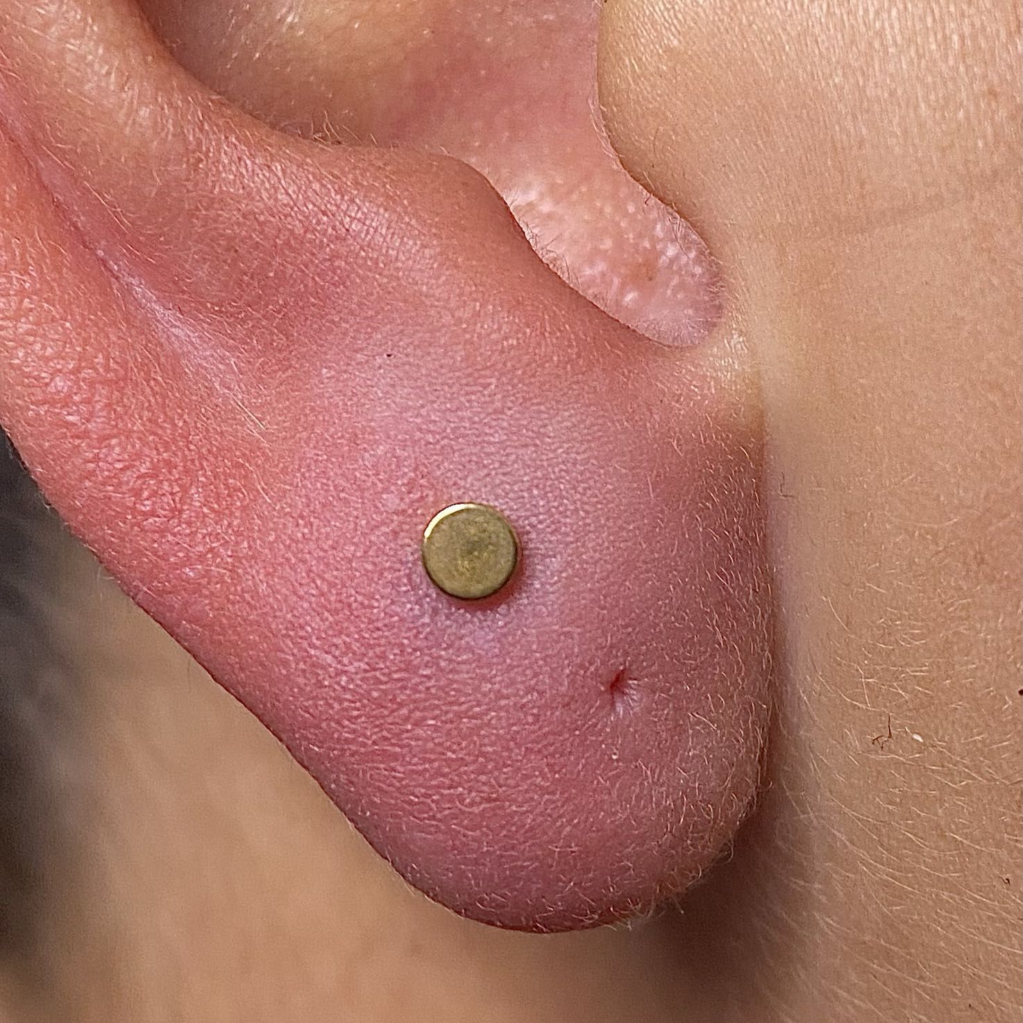 Simple Ear Piercing (Helix, Lobe, Flat) portfolio