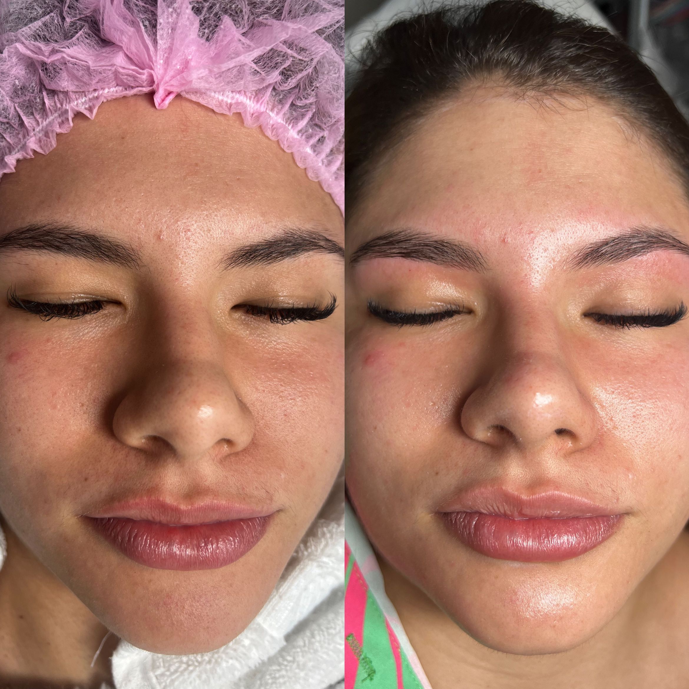 Facial Cleansing /  Limpieza Facial portfolio