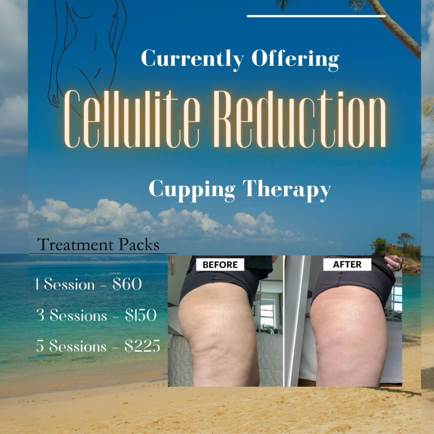 Cellulite Reduction Cupping portfolio