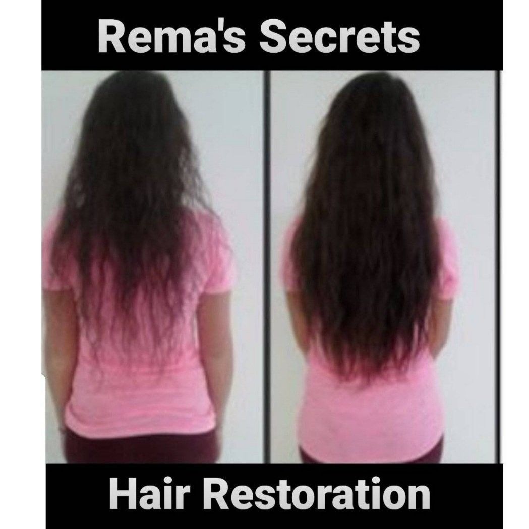 Hair Restoration Red Light Therapy portfolio