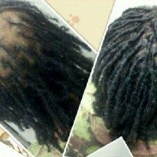 Loc Rehab Hairloss & Restoration, 6846 Racetrack Road, Bowie, MD 20715  ste#101, Bowie, MD, 20715