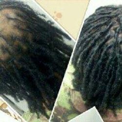 Loc Rehab Hairloss & Restoration, 6846 Racetrack Road, Bowie, MD 20715  ste#101, Bowie, MD, 20715