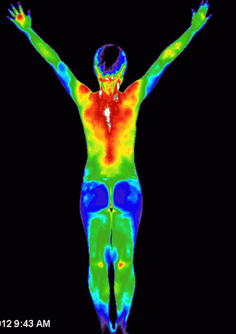 Northeast Thermography Medical Imaging, Clifton Park, 12065