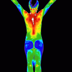 Northeast Thermography Medical Imaging, Clifton Park, Clifton Park, 12065